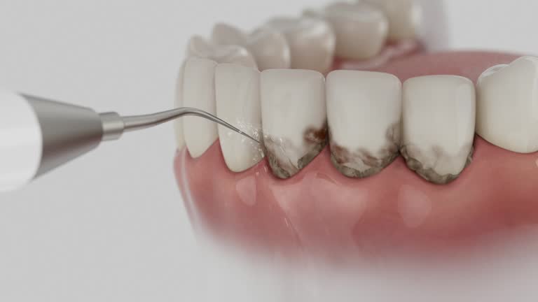 Trusted Tooth Extraction service in Choctaw, OK - Dentist Open Now